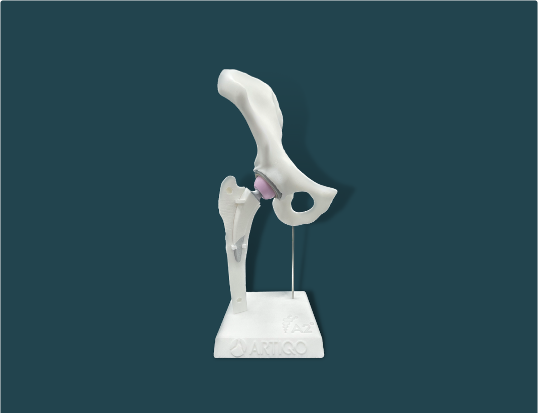 Open display for hip prosthesis