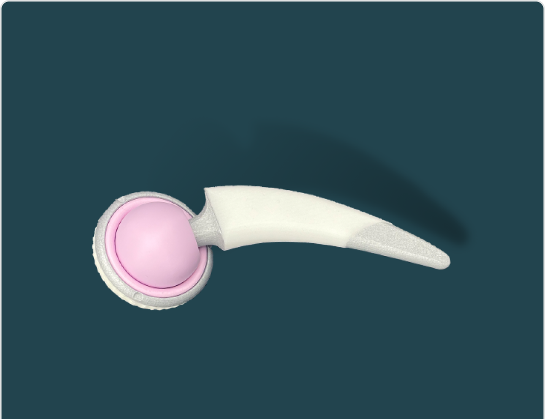Hip implant with surface treatment