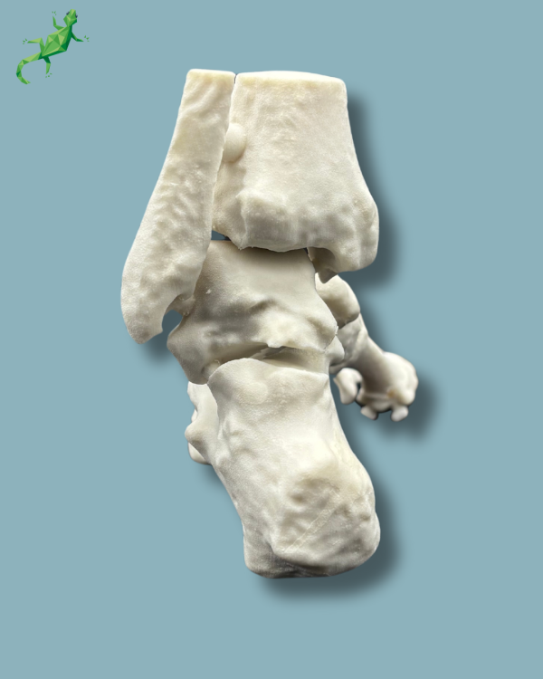 Cavus foot model left, Addi-CORT+ - Ref 02-32-01 - Image 8