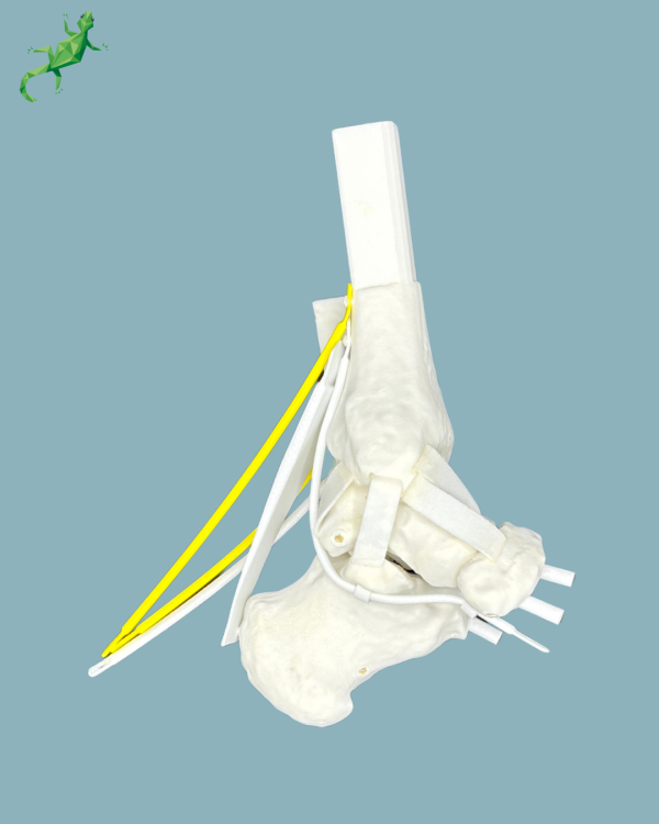 Replaceable hindfoot / Addi-CORT+ Addi-SOFT Addi-ARC - Ref 02-04-02 - Image 2