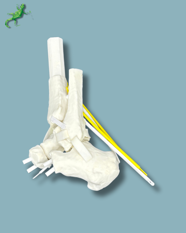 Replaceable hindfoot / Addi-CORT+ Addi-SOFT Addi-ARC - Ref 02-04-02