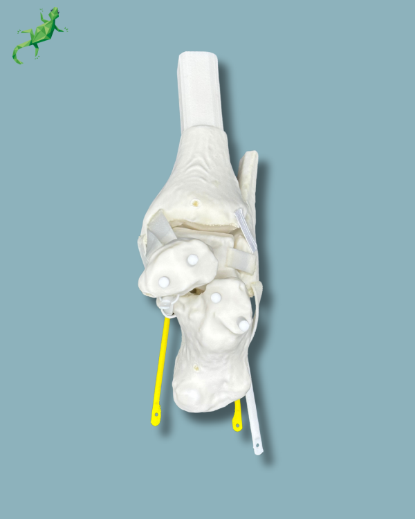 Replaceable hindfoot / Addi-CORT+ Addi-SOFT Addi-ARC - Ref 02-04-02 - Image 9