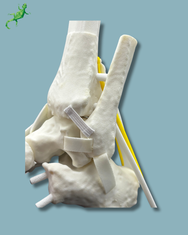 Replaceable hindfoot / Addi-CORT+ Addi-SOFT Addi-ARC - Ref 02-04-02 - Image 7