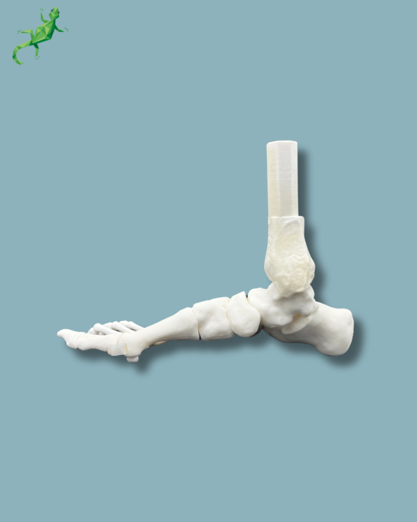 Flatfoot model with forefoot deformities, right, Addi-CORT+ - Ref 02-31-01