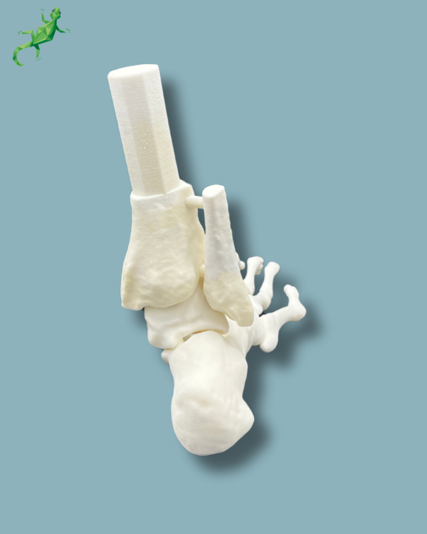 Flatfoot model with forefoot deformities, right, Addi-CORT+ - Ref 02-31-01 - Image 5