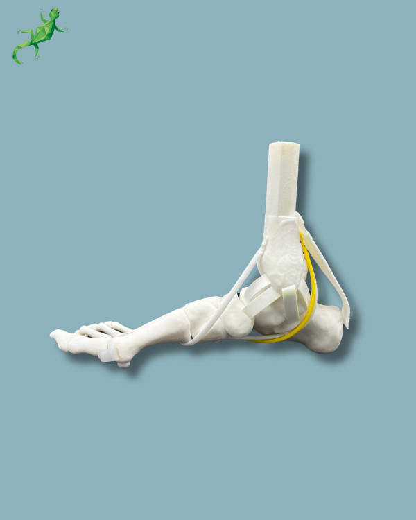 Flatfoot model with forefoot deformities, right, with ligaments/tendons on the ankle - Ref 02-07-02