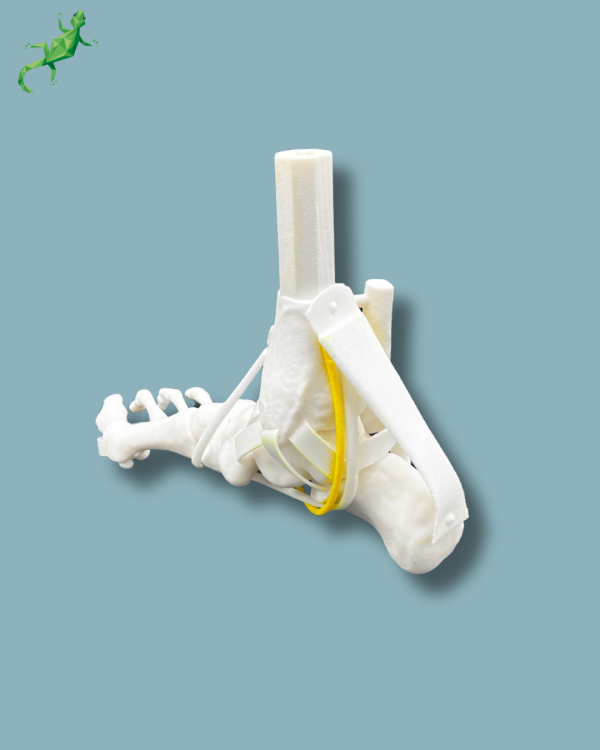 Flatfoot model with forefoot deformities, right, with ligaments/tendons on the ankle - Ref 02-07-02 - Image 8