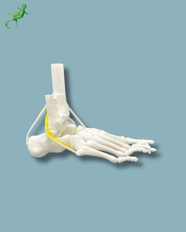 Flatfoot model with forefoot deformities, right, with ligaments/tendons on the ankle - Ref 02-07-02 - Image 2