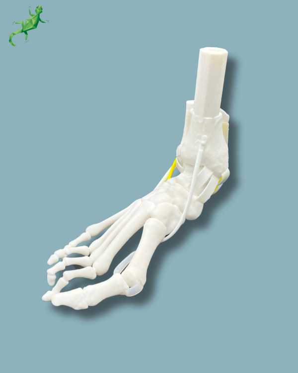 Flatfoot model with forefoot deformities, right, with ligaments/tendons on the ankle - Ref 02-07-02 - Image 3