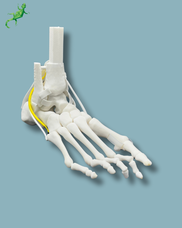 Flatfoot model with forefoot deformities, right, with ligaments/tendons on the ankle - Ref 02-07-02 - Image 5
