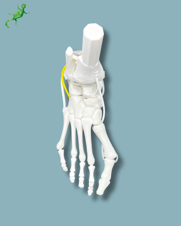 Flatfoot model with forefoot deformities, right, with ligaments/tendons on the ankle - Ref 02-07-02 - Image 6
