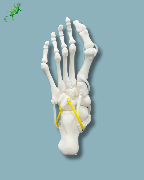 Flatfoot model with forefoot deformities, right, with ligaments/tendons on the ankle - Ref 02-07-02 - Image 10