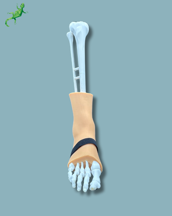 Foot and tibia with a COFAS 1 ankle arthritis with ligaments/tendons/retinaculum and skin - Ref 02-01-02