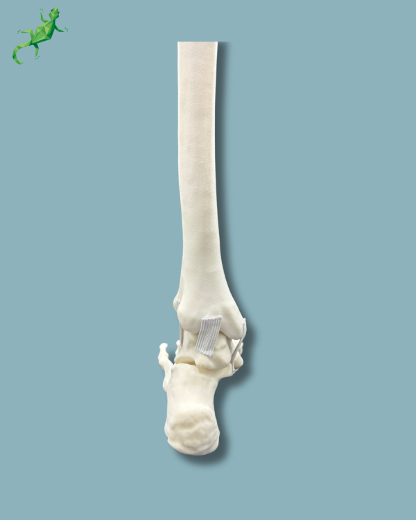 Pied-Cheville et Tibia / Gauche / Addi CORT+ - Ref 02-08-02 – Image 7