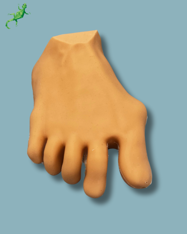 Forefoot with deformity, radioopacity and skin - Ref 01-12-03 - Image 2