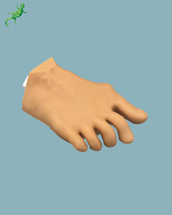 Forefoot with deformity, radioopacity and skin - Ref 01-12-03 - Image 7