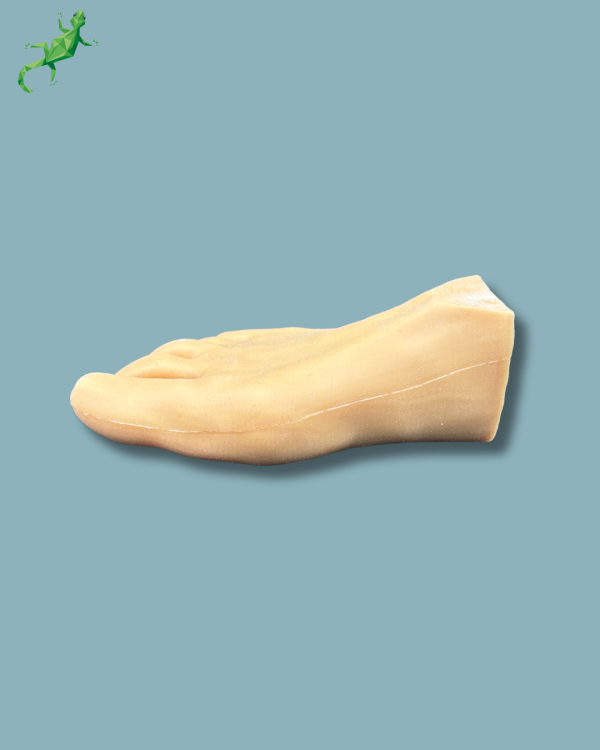 Forefoot with deformity, radioopacity and skin - Ref 01-12-02 - Image 2