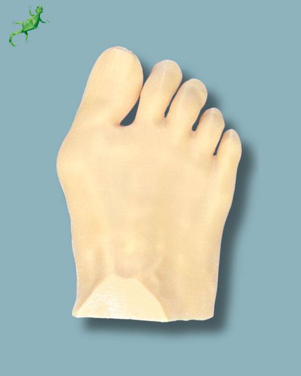Forefoot with deformity, radioopacity and skin - Ref 01-12-02 - Image 4