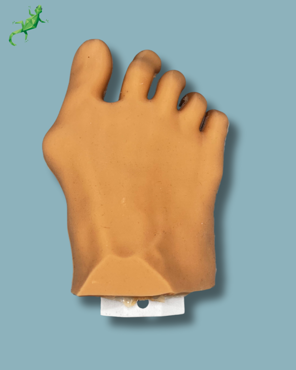 Forefoot with deformity, radioopacity and skin - Ref 01-12-03 - Image 3