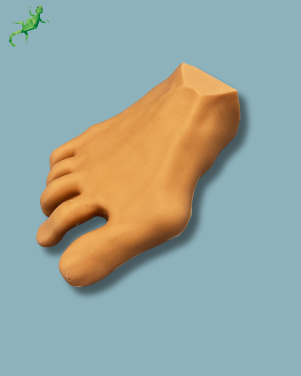 Forefoot with deformity, radioopacity and skin - Ref 01-12-03