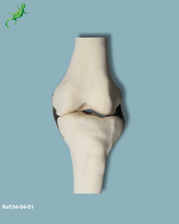 Knee / Medium / Left / Addi-CORT with intramedullar canal - Ref 04-04-01 - Image 4