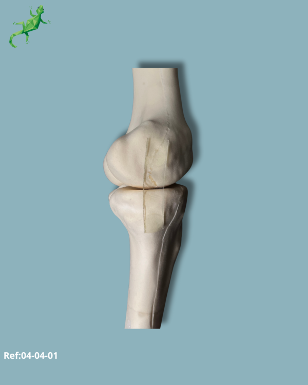 Knee / Medium / Left / Addi-CORT with intramedullar canal - Ref 04-04-01 - Image 3