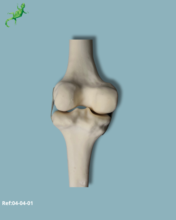 Knee / Medium / Left / Addi-CORT with intramedullar canal - Ref 04-04-01 - Image 5