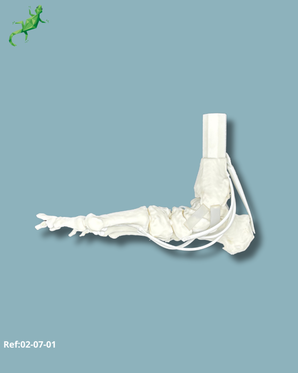 Stade 3 Flatfoot model with Hallux Valgus / Right / Addi-CORT+ Addi-SOFT Addi-CLAMP - Ref 02-07-01