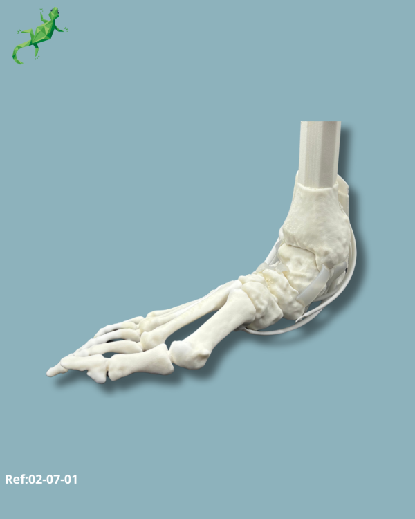 Stade 3 Flatfoot model with Hallux Valgus / Right / Addi-CORT+ Addi-SOFT Addi-CLAMP - Ref 02-07-01 - Image 3