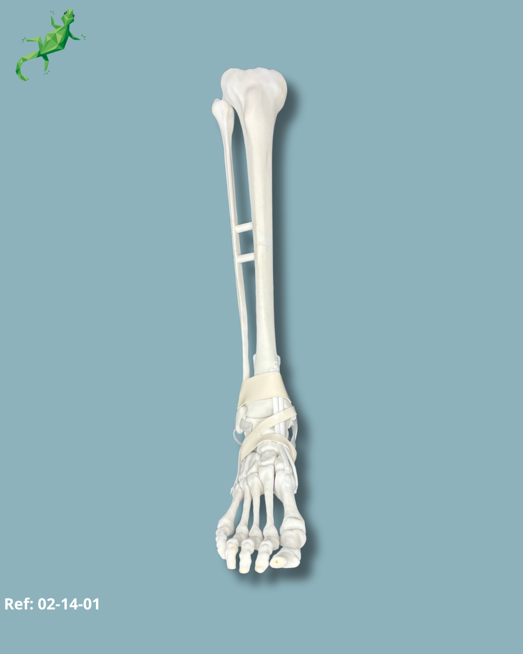 Pied et tibia avec un COFAS 1 Varus et cheville arthrosique / Droit / Addi CORT+ Addi-SOFT – Ref 02-14-01