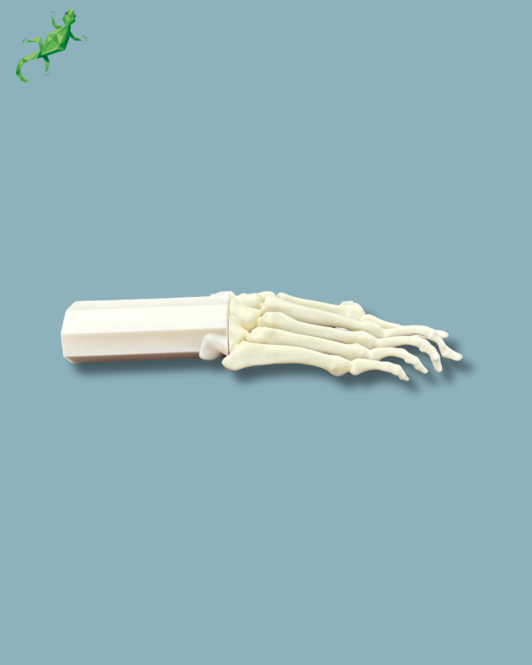 Pack 'Forefoot with deformity' + 'Vise attachment', right - Ref 01-14-02 - Image 6