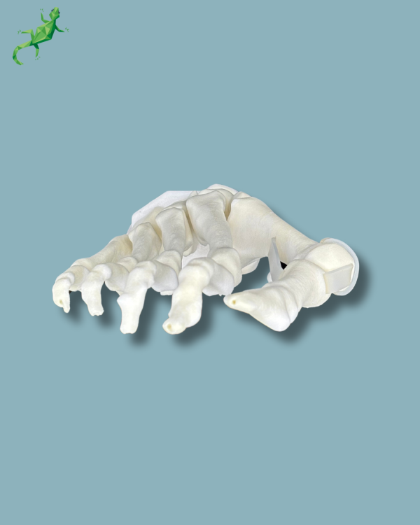 Pack 'Avant-Pied avec malformation' + 'Bloc réutilisable', droit - Ref 01-14-02 – Image 5