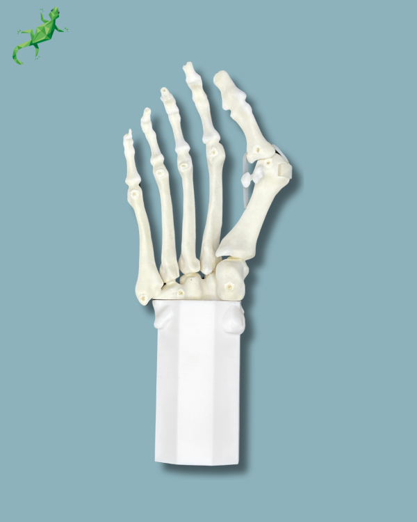 Pack 'Forefoot with deformity' + 'Vise attachment', right - Ref 01-14-02 - Image 3
