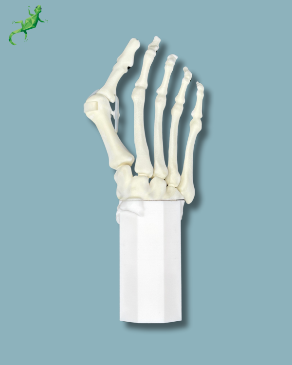 Pack 'Avant-Pied avec malformation' + 'Bloc réutilisable', droit - Ref 01-14-02 – Image 2