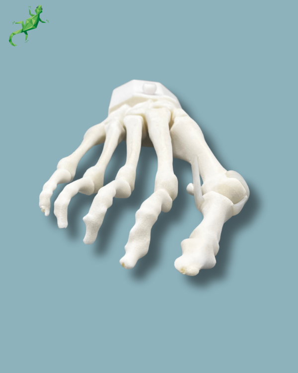 Pack 'Forefoot with deformity' + 'Vise attachment', right - Ref 01-14-02 - Image 2
