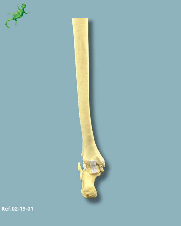 Foot and tibia / Medium / Left / Addi-CORT with intramedullar canal - Ref 02-19-01 - Image 3