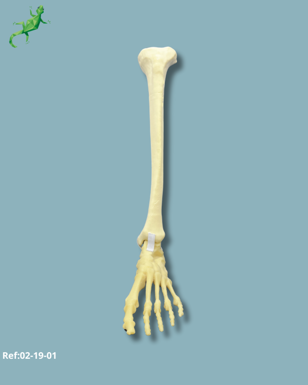 Foot and tibia / Medium / Left / Addi-CORT with intramedullar canal - Ref 02-19-01 - Image 4