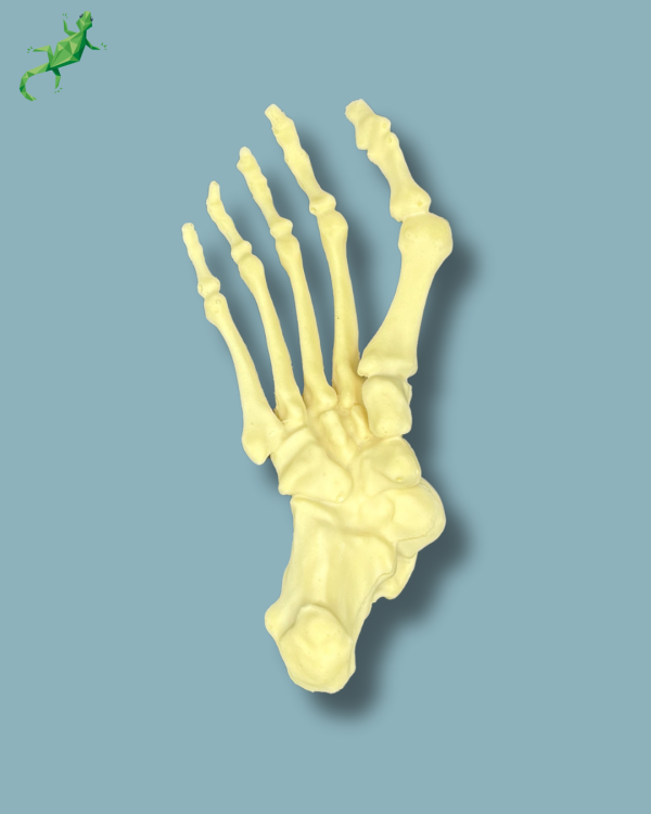 Flatfoot with forefoot deformities / Right / Addi CAN - Ref 01-07-02 - Image 5