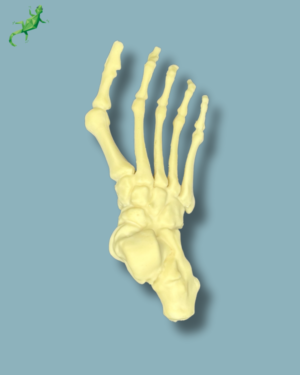 Flatfoot with forefoot deformities / Right / Addi CAN - Ref 01-07-02 - Image 4