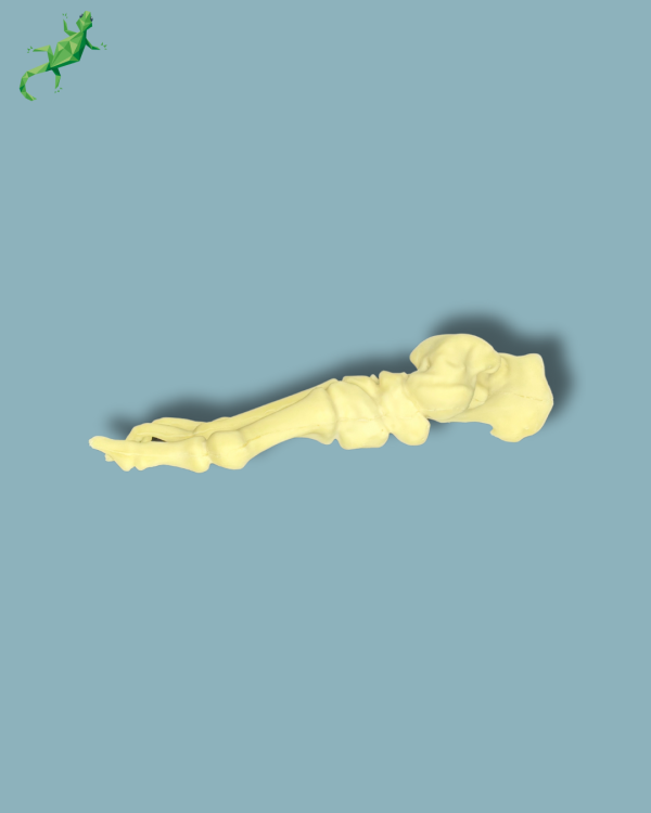 Flatfoot with forefoot deformities / Right / Addi CAN - Ref 01-07-02 - Image 6