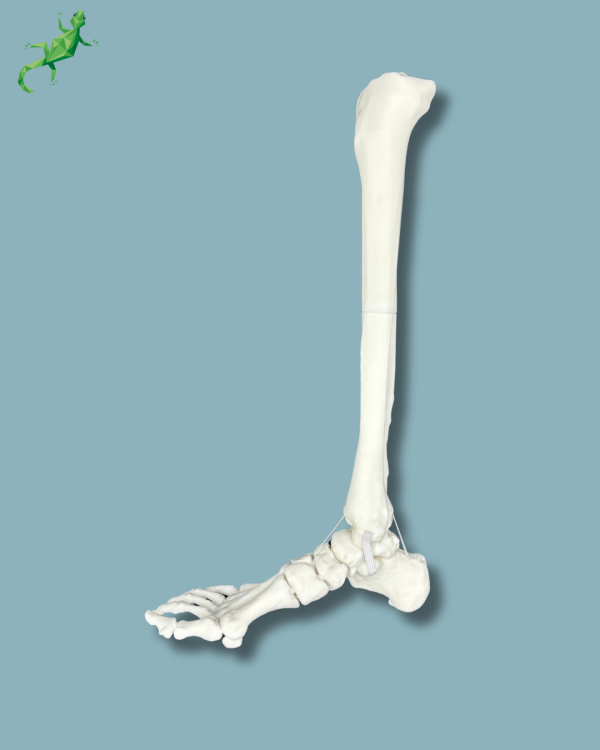 Foot and Tibia with a COFAS 1 Ankle arthritis, Addi-CORT+ - Ref 02-09-02 - Image 3