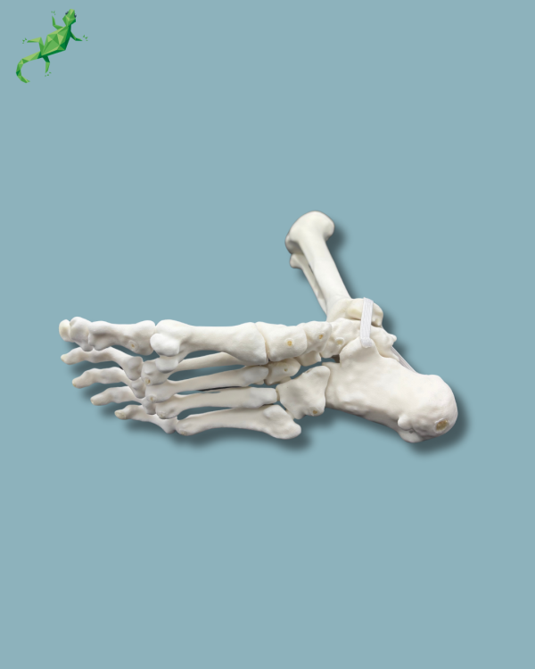 Foot and Tibia with a COFAS 1 Ankle arthritis, Addi-CORT+ - Ref 02-09-02 - Image 7