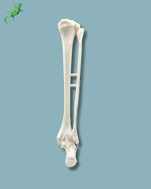 Foot and Tibia with a COFAS 1 Ankle arthritis, Addi-CORT+ - Ref 02-09-02 - Image 4