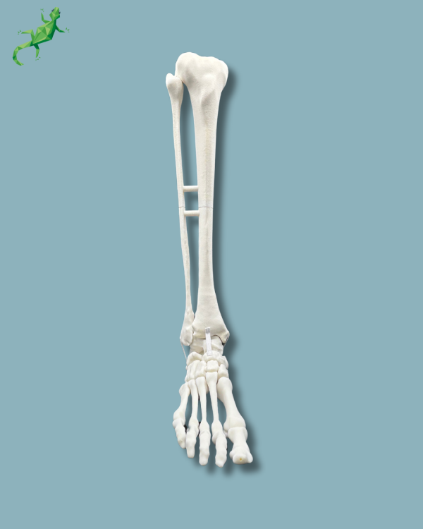 Foot and Tibia with a COFAS 1 Ankle arthritis, Addi-CORT+ - Ref 02-09-02 - Image 5