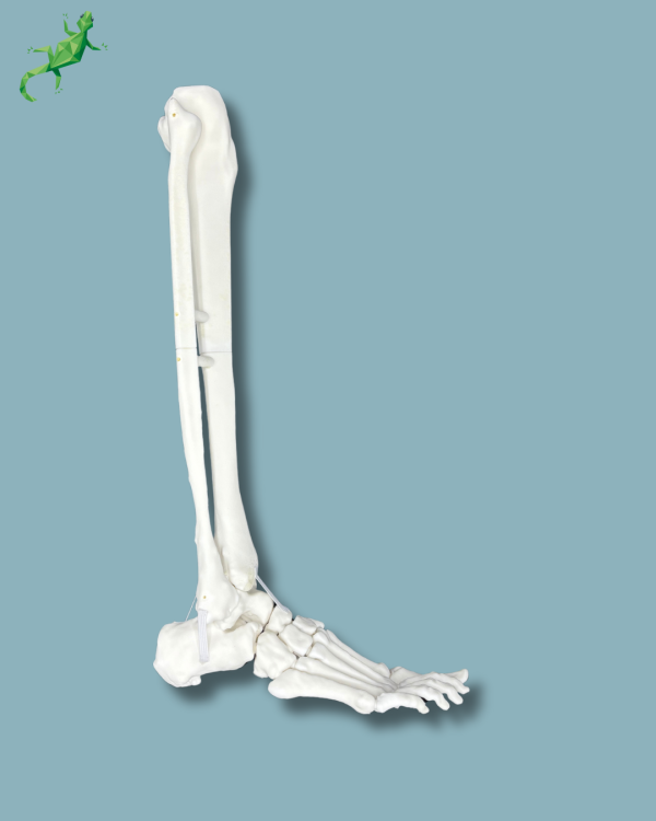 Foot and Tibia with a COFAS 1 Ankle arthritis, Addi-CORT+ - Ref 02-09-02 - Image 2
