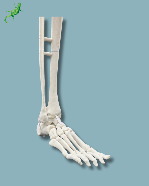 Foot and Tibia with a COFAS 1 Ankle arthritis, Addi-CORT+ - Ref 02-09-02 - Image 6