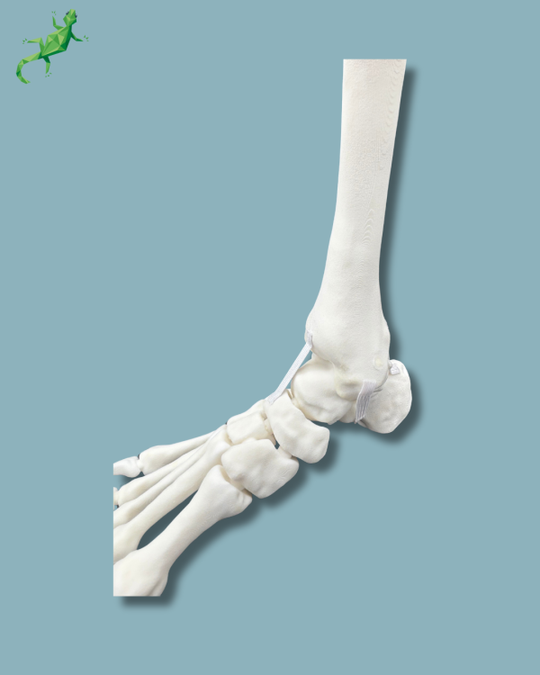 Foot and Tibia with a COFAS 1 Ankle arthritis, Addi-CORT+ - Ref 02-09-02 - Image 9