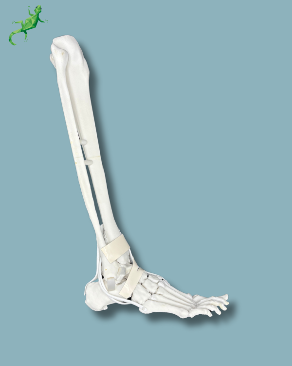 Pied et tibia avec arthrose de la cheville COFAS 1 avec ligaments/tendons/rétinaculum - Ref 02-14-02 – Image 4