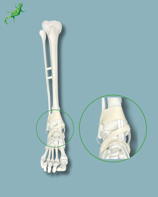 Pied et tibia avec arthrose de la cheville COFAS 1 avec ligaments/tendons/rétinaculum - Ref 02-14-02