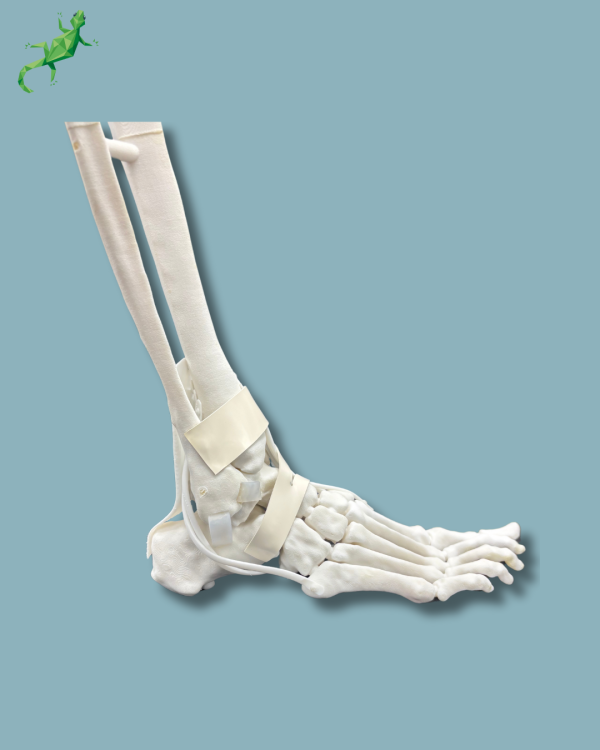 Pied et tibia avec arthrose de la cheville COFAS 1 avec ligaments/tendons/rétinaculum - Ref 02-14-02 – Image 5